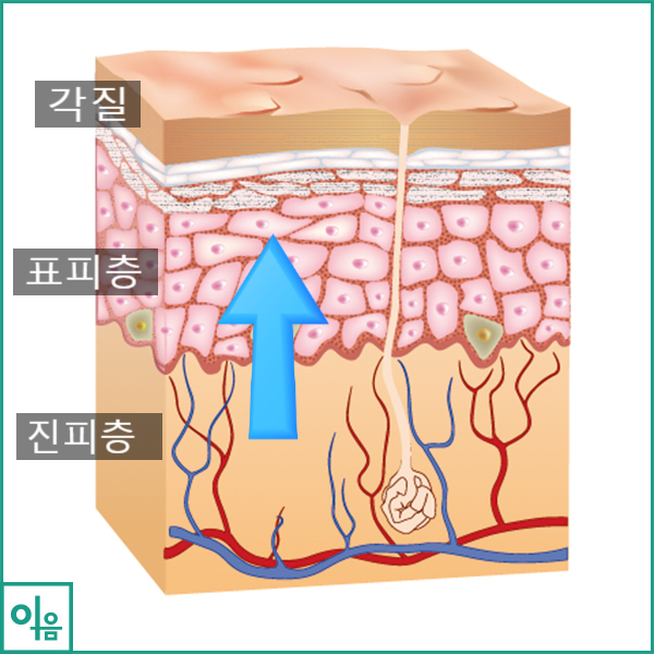 여자 헤르페스 2형 재발하는 이유 및 궁금한 점 총정리 (사진 첨부) : 네이버 블로그