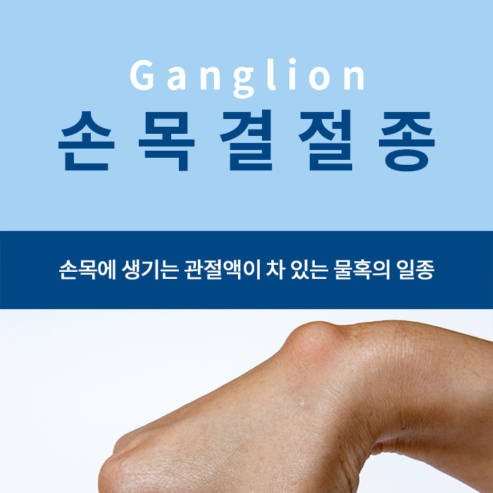 손목에 생긴 혹, 손목 결절종(Ganglion). 자연치유 가능한가? : 네이버 블로그