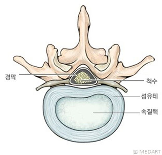 추간판 탈출증.. 운동하기에 앞서 알아야 할 것들! : 네이버 블로그