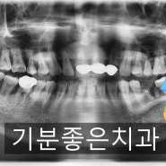 [부천상동치과/상동역치과/기분좋은치과/임플란트/부천임플란트] 임플란트 잘하는 곳 기분좋은치과입니다.