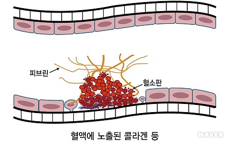 지혈의 원리, 제대로 지혈하는 방법 - 주사, 코피, 동맥까지(feat. 방사선사) : 네이버 블로그