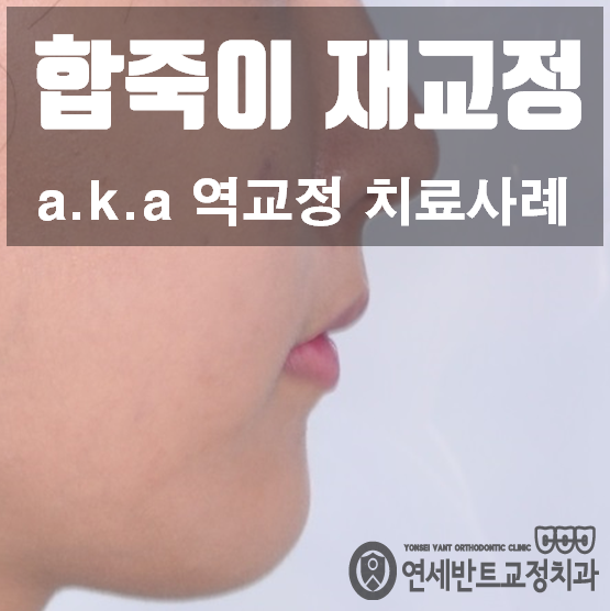 합죽이 재교정 / 역교정 치료사례 : 네이버 블로그