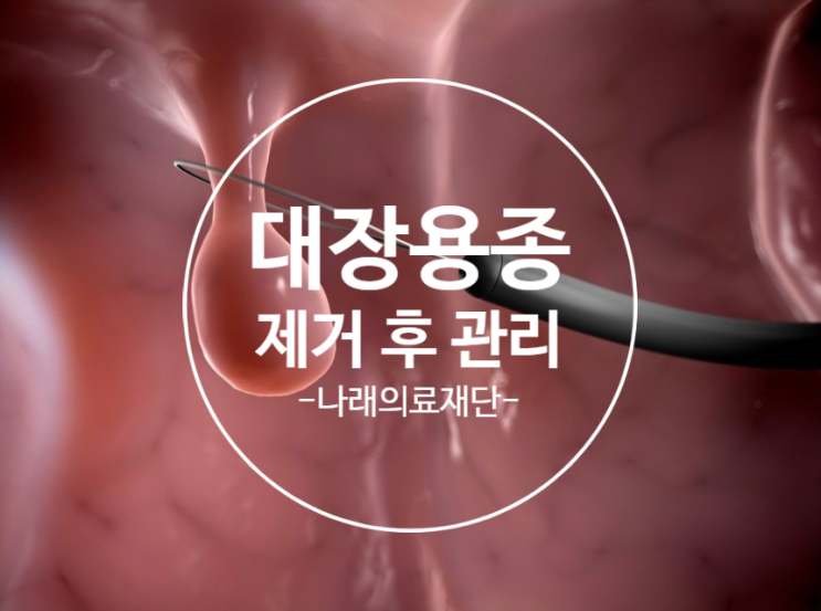 대장용종 제거후 식사 음주 : 네이버 블로그