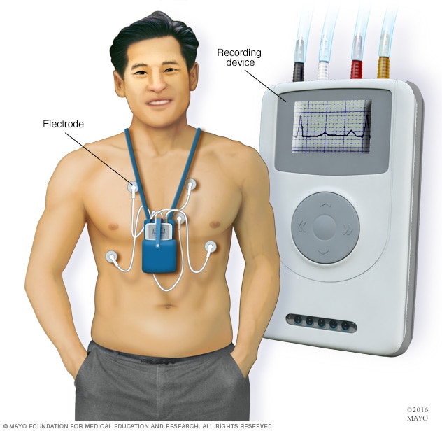  24hr holter monitoring 24 