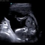 임신 16주차 : 2차기형아검사 + 성별확인 + 첫 태동