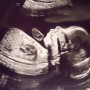 임신 21주차 : 중기 정밀 초음파 + 산전검사
