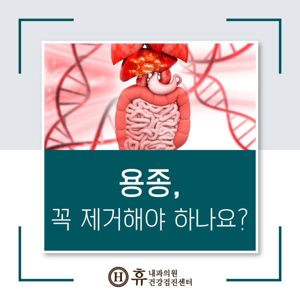 대장내시경 중 용종절제, 용종은 꼭 제거해야 하는 건가요? : 네이버 블로그
