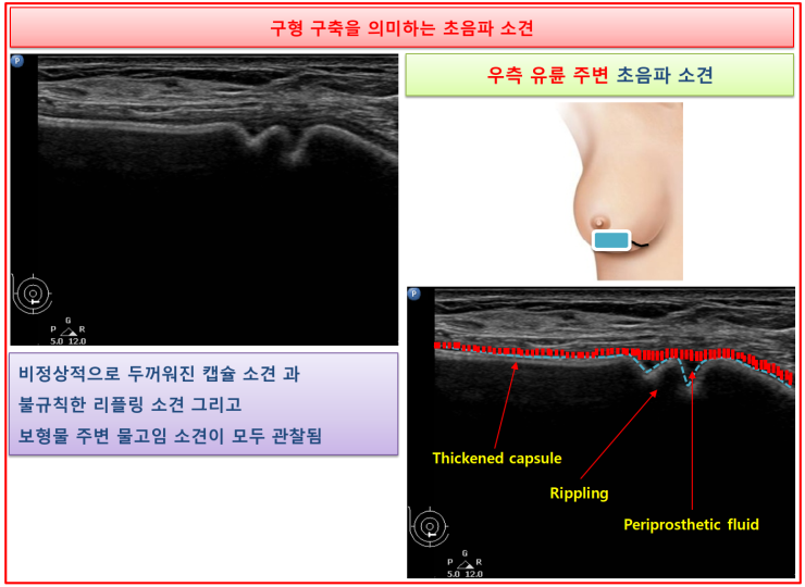 논문 