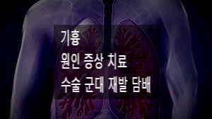 기흉 원인 증상 치료 수술 군대 재발 담배 : 네이버 블로그