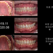 가지런한용인치과 가 잘하는 진료는?