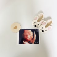 임신기록 : 28-31w 쭈기 diary (임신8개월)