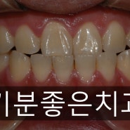 [부천상동교정치과/교정치과/상동치과/교정치료]