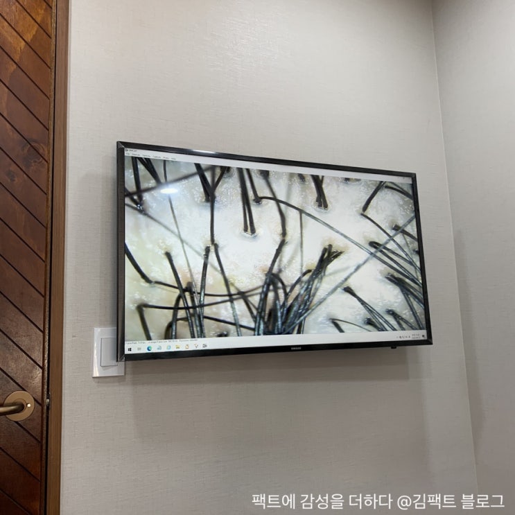 강남 맥스웰피부과 탈모 치료 상담 : 네이버 블로그