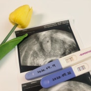임신기록 4주~12주까지 증상, 1차 기형아 검사