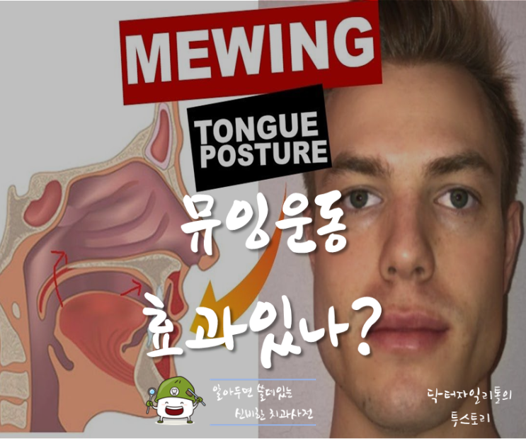 뮤잉운동의 올바른 혀 위치 효과 부작용 :: 턱살 빼는 운동 mewing 후기 by 닥터자일리톨 알쓸신치 : 네이버 블로그