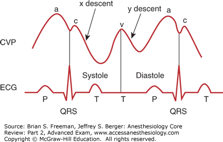 CVP(central venous pressure) : 네이버 블로그