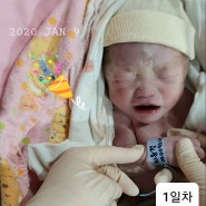 [출산후기] 임신 38주 4일 선택제왕 후기 / 레나의 리얼 출산후기 열무가 태어났어요 !!