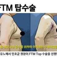 FTM 수술이 뭔가요?