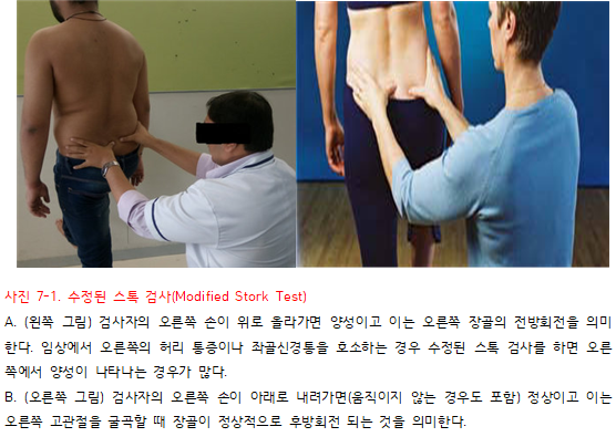 천골 비틀림의 이학적 검사 - 수정된 스톡 검사(Modified Stork Test) : 네이버 블로그