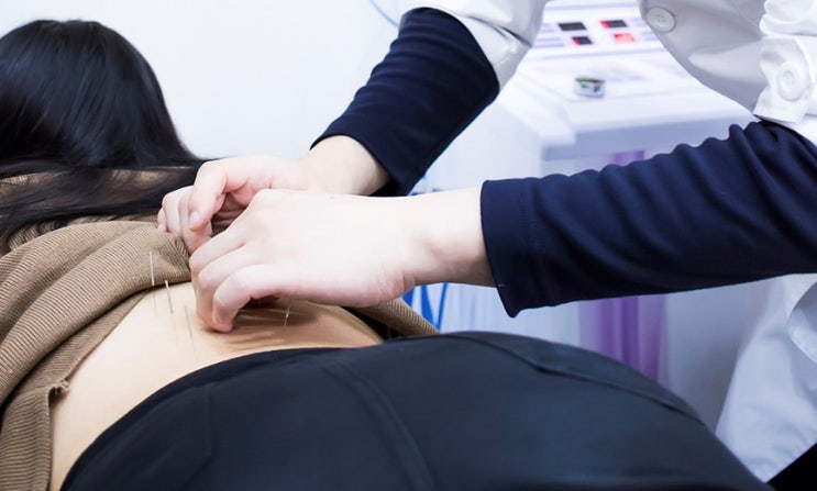 대상포진 후유증, 대상포진 후 신경통 증상과 치료방법 : 네이버 블로그