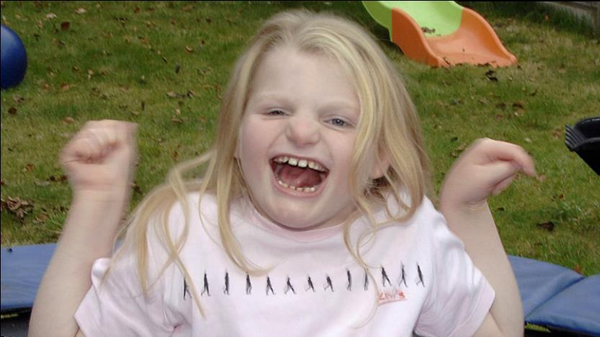 엔젤만 증후군을 앓고 있는 성인