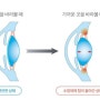 중랑구 안경점에서 누진 다초점 안경 맞춰봐