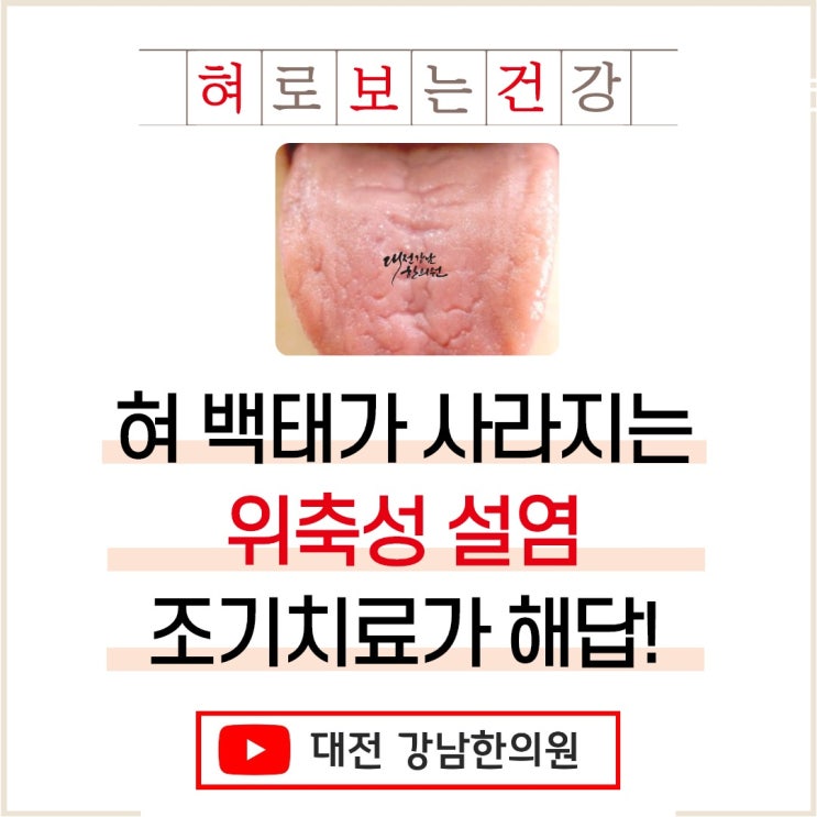 혀백태가 없어져서 갈라지고 아픈 위축성설염, 원인은 진액부족! : 네이버 블로그