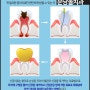 정자역치과 정자역신경치료 아프지않게하는 분당올치과