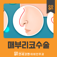 까다로운 매부리코수술은? 연세코앤에서!