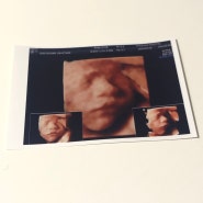 임신일기(24주-27주)/임신7개월 정밀초음파& 이사를가요& 임당검사& 빈혈검사& 입체초음파