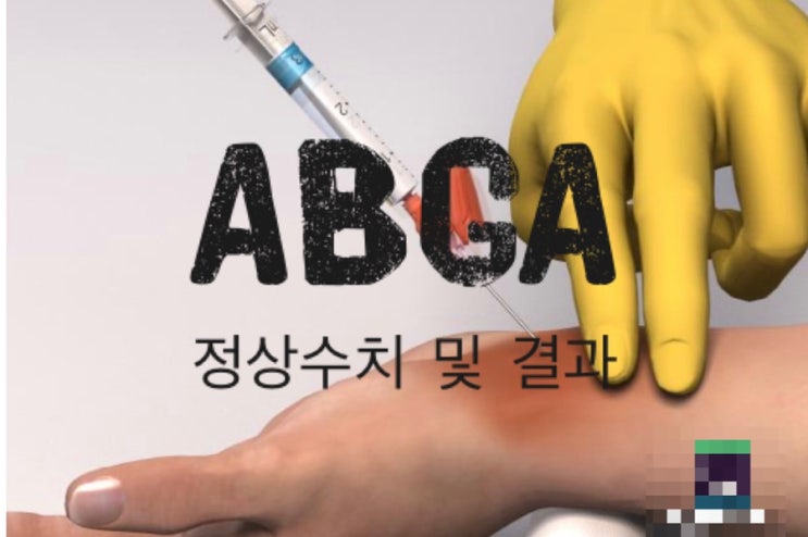 ABGA (혈액가스분석) : 네이버 블로그