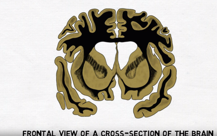 corpus callosum 뇌량 : 네이버 블로그