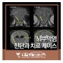 김포동물병원_강아지 경련&발작 뇌수막염 진단과 치료 케이스