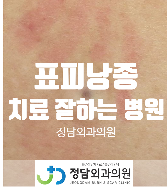 표피낭종, 피지낭종 치료 잘하는 병원 - 인천 정담외과의원 : 네이버 블로그