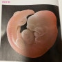 임신초기증상 중요한 것들 :)