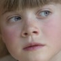 축농증과 어린이(소아) 입 냄새 관련이 있을까요?