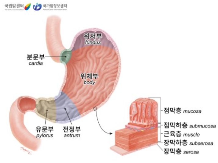 [Stomach cancer, 위암] : 네이버 블로그