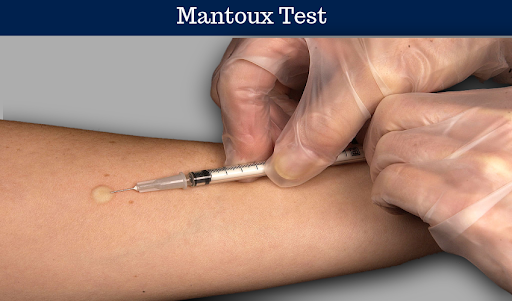 투약) 7-4. 피내주사, InteraDermal Injection : 네이버 블로그