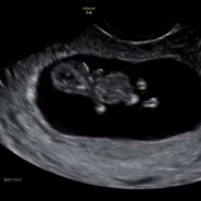 임신 초기 : 10주 정기검진 / 산후조리원 예약 / 태아보험