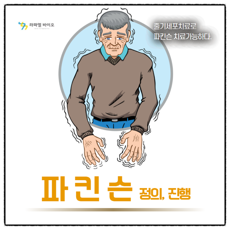 파킨슨 증상과 파킨슨병 줄기세포치료 : 네이버 블로그