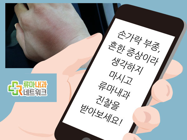 엄지손가락 붓기 갑자기 손가락이 부었어요 이럴 땐!! : 네이버 블로그