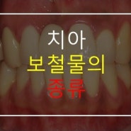 치과 보철물 종류