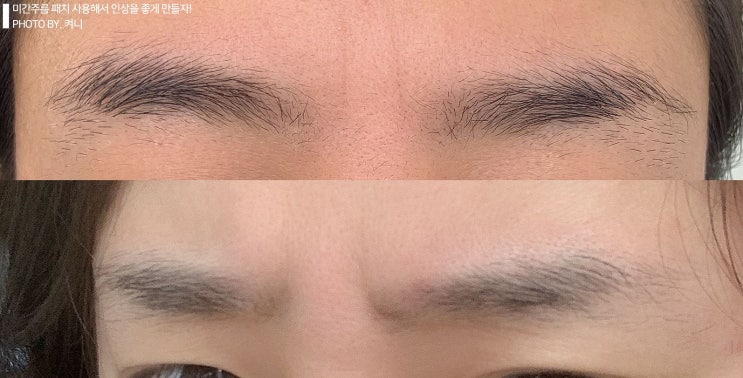 미간주름 패치 사용해서 인상을 좋게 만들자! : 네이버 블로그
