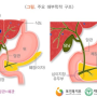 [Nurse] 내시경 역행 췌담관 조영술(ERCP) 시술 전 후 간호