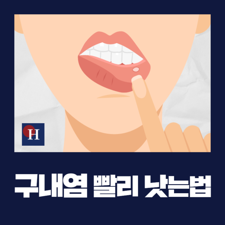 입병 구내염 원인 7가지와 빨리 낫는법! : 네이버 블로그