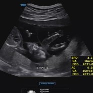 16주 임산부 일상 - 쌍둥이 성별 두구두구두구