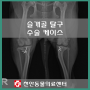 슬개골 탈구 수술 케이스 : 천안 동물병원