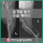 슬개골 탈구 수술 케이스 : 천안 동물병원