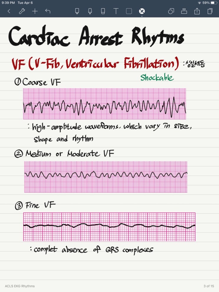 [ACLS provider] EKG rhythms : 네이버 블로그