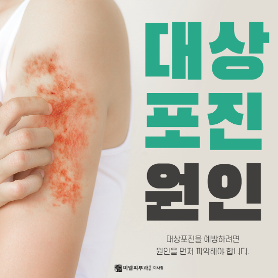 [하남피부과] 고통스러운 대상포진, 원인이 뭘까? : 네이버 블로그